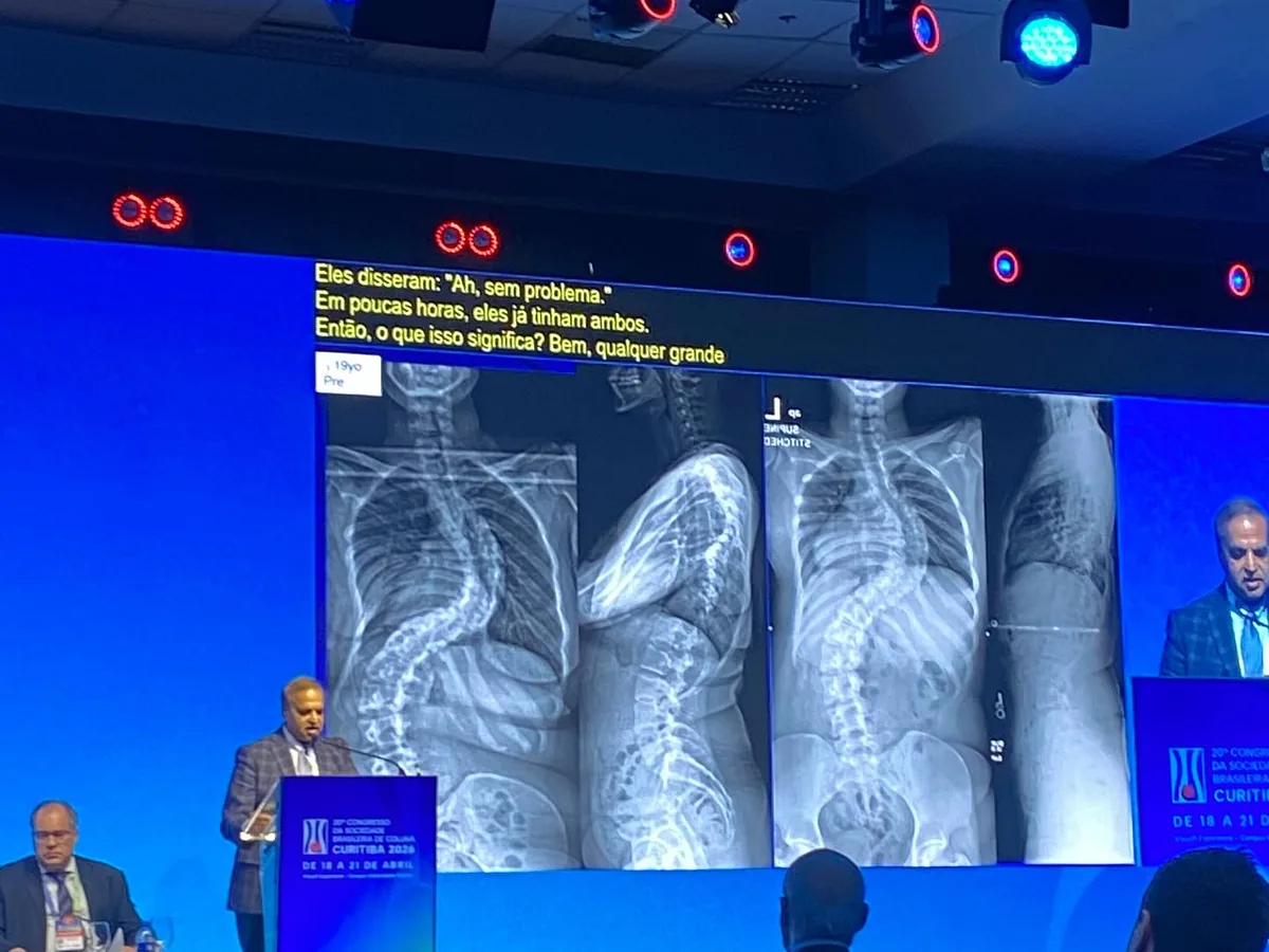 Palestra sobre deformidades da coluna no Congresso da SBC